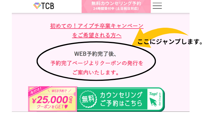 TCBで二重整形を4800円で受けるための5ステップ